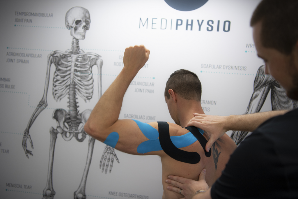 Shoulder taping physiotherapy