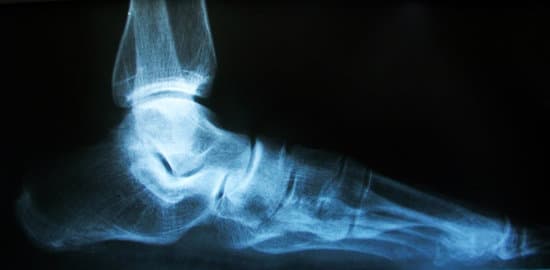 X-ray image of normal foot side