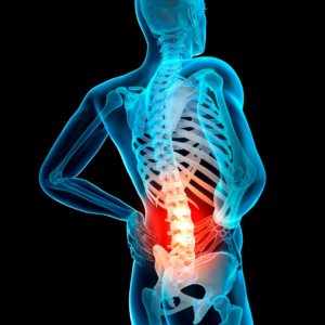 LUMBAR DISC INJURIES AND PHYSIO - MediPhysio