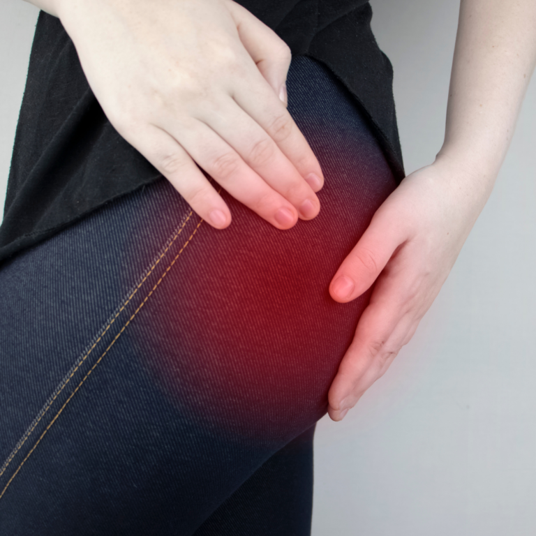 POSTERIOR BUTTOCK PAIN - MediPhysio